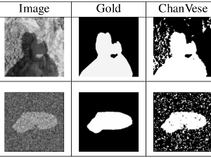 Multi-resolution Level Set Image Segmentation Using Wavelet